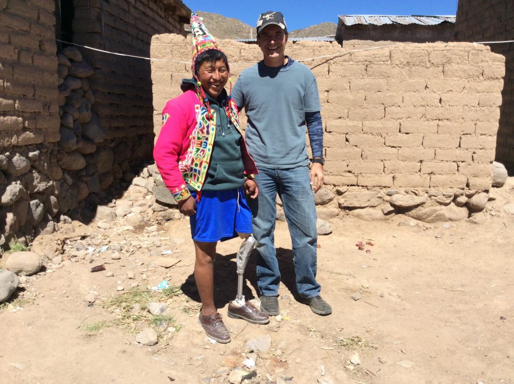 Steve with Augustine showing off his new leg