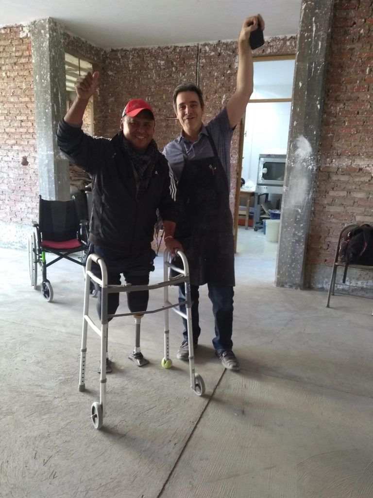 Man standing for the first time on two new legs with Steve