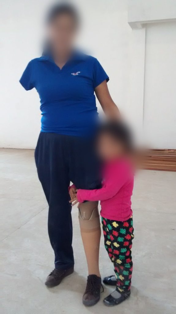 Aby standing on her new leg with her daughter for the first time.